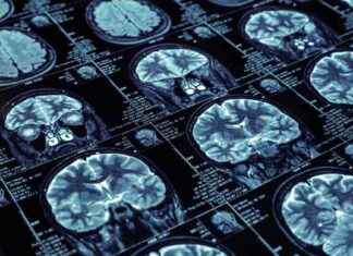 Protecting Consumer Privacy: Tech Gadgets and Brain Wave Capture news-17082024-202645